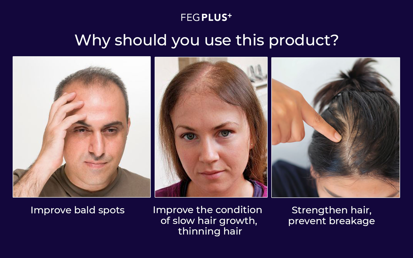 FEG Plus Hair Growth Spray (50ml)