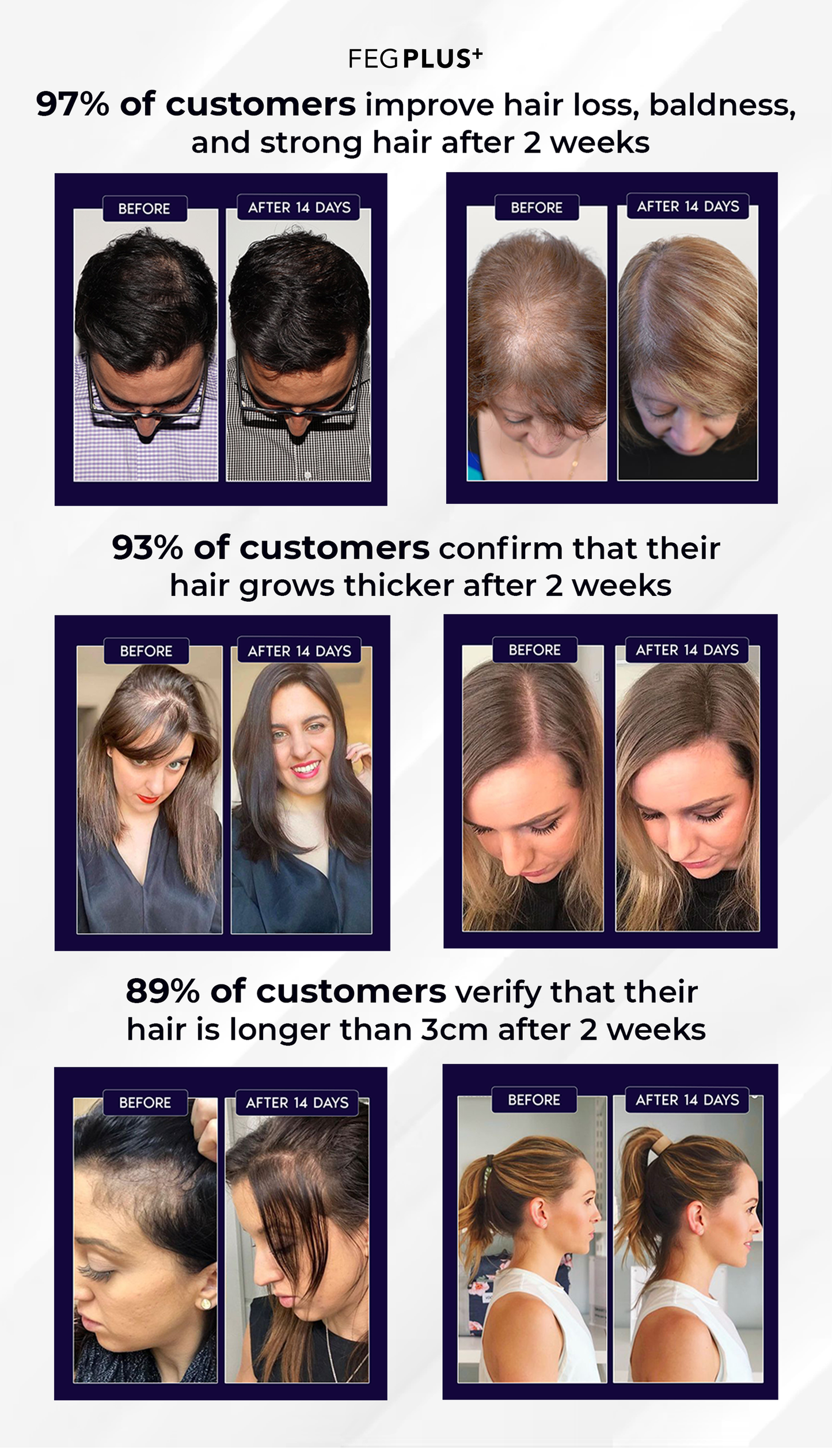 FEG Plus Hair Growth Spray (50ml)